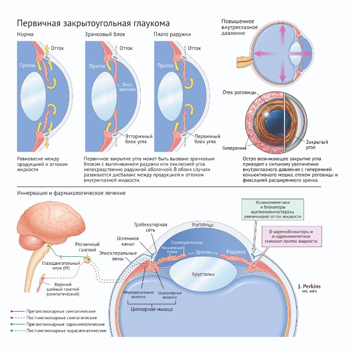 Схема оттока внутриглазной жидкости