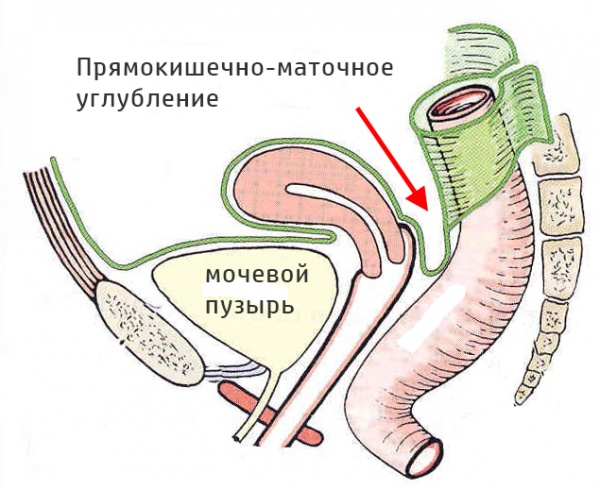 Дугласовом пространстве. Прямокишечно-маточное углубление анатомия. Пузырно маточное углубление анатомия. Анатомия дугласова пространства. Прямокишечно-маточное углубление (Дугласа).