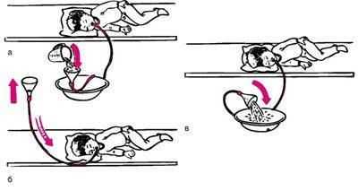 Промывание желудка без сознания. Зондовое промывание кишечника алгоритм. Схема алгоритм промывание желудка. Промывание желудка у детей. Рвота промывание желудка.