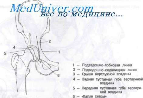 Проекция тазобедренного сустава